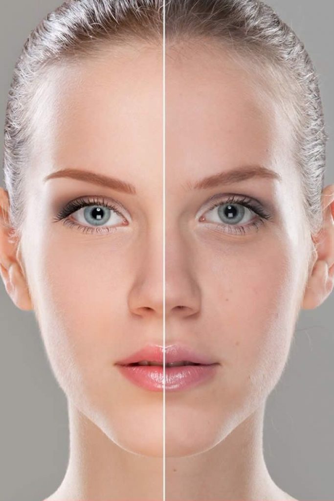 Remedies for Face Lifts in the Home Environment