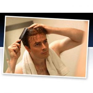 Male Pattern Baldness