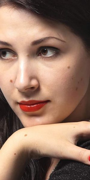 Home Remedies For Mole Removal
