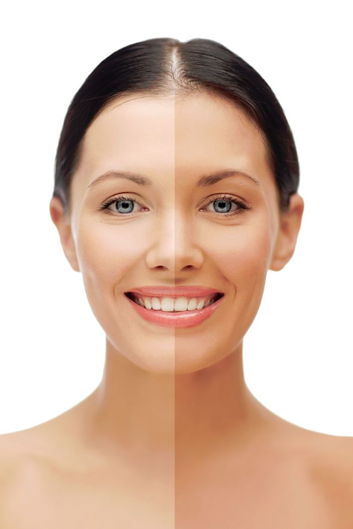 How to Remove Summer Tan