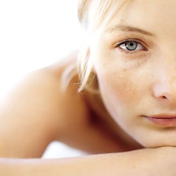 How to Get Rid of Brown Spots Using Home Remedies