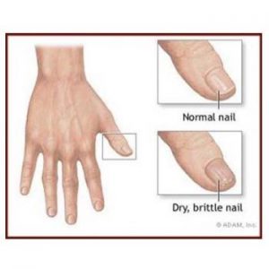 Tips To Have Strong And Healthy Nails
