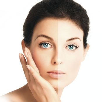 Get a whitening Skin