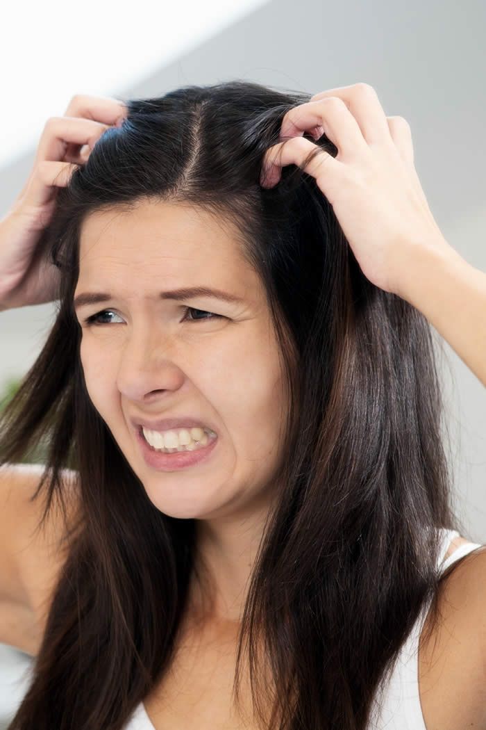 3 Terrible Winter Hair Problems & The Solutions