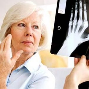 What is Rheumatoid Arthritis?