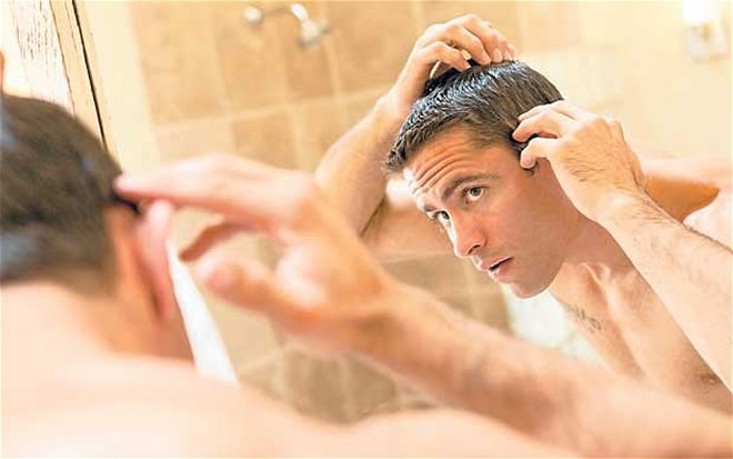home remedies for mens hair loss