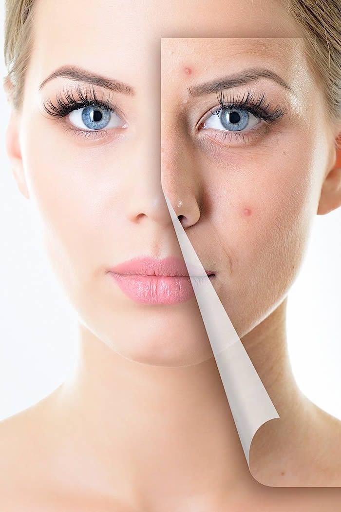5 Non Invasive Solutions for Common Skin Complaints