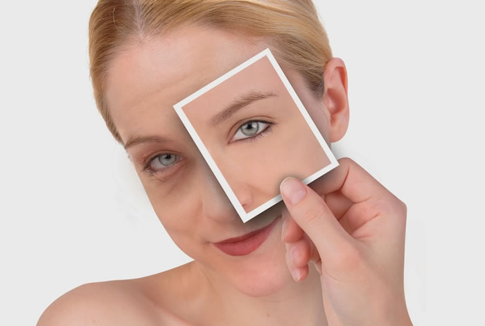 To Get Rid of Dark Circles