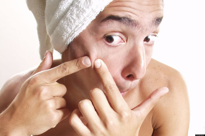 Popping Pimples Makes Acne Disappear