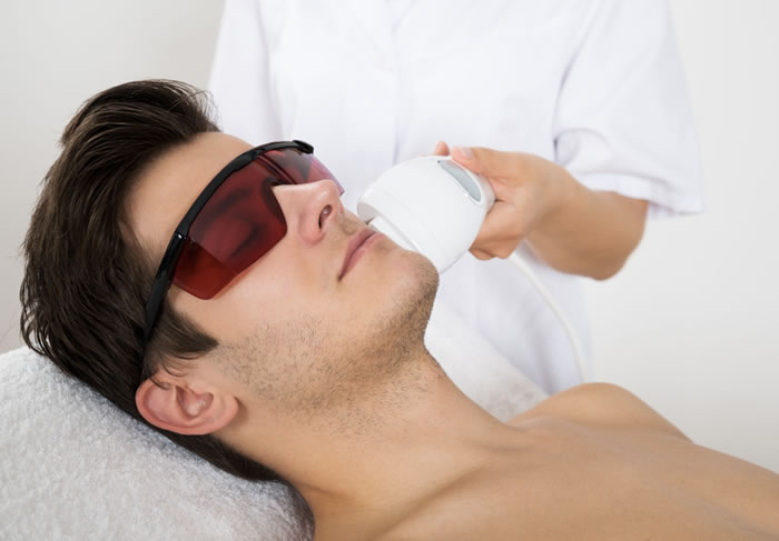 LASER HAIR REMOVAL