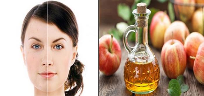 6 Home Remedies With Which You Can Get Rid Of Expensive Beauty Products