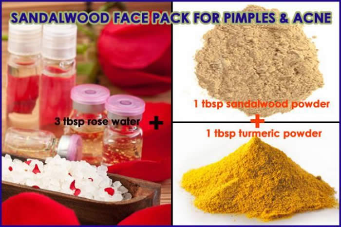 7 Best Sandalwood Face Packs For All Brides-to-be To Get Gorgeous Naturally