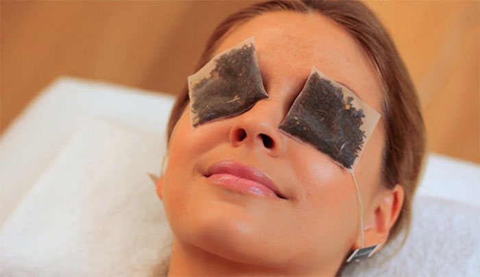 How to Get Rid of Puffy Eyes Fast