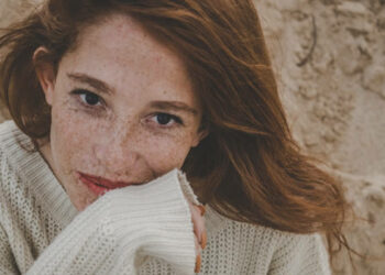 Best Treatments To Fade Away Skin Discolourations