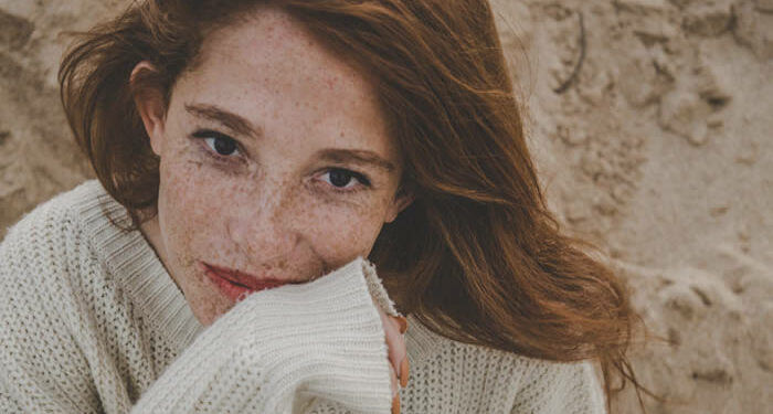 Best Treatments To Fade Away Skin Discolourations