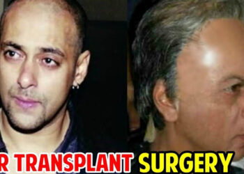 Bollywood Stars Who Got Hair Transplant To Hide Baldness