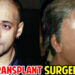 Bollywood Stars Who Got Hair Transplant To Hide Baldness