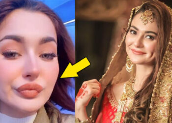 Hania Amir trolled for Lip Plastic Surgery ‘Gone Wrong’?. See Pics