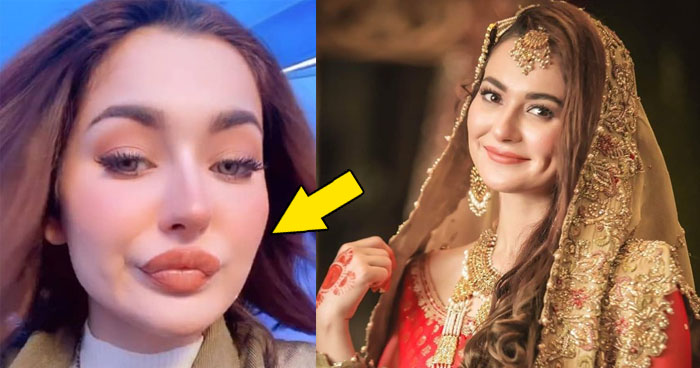 700px x 368px - Hania Aamir trolled for Lip Plastic Surgery 'Gone Wrong'?. See Pics