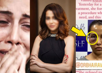 SHOCKING! This Popular Indian Actresses Plastic Surgery Gone Wrong