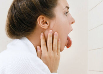 The Real Reason You Have Cracks On Your Tongue