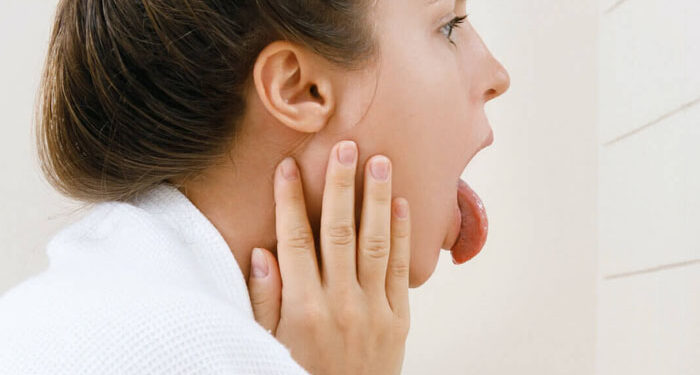 The Real Reason You Have Cracks On Your Tongue