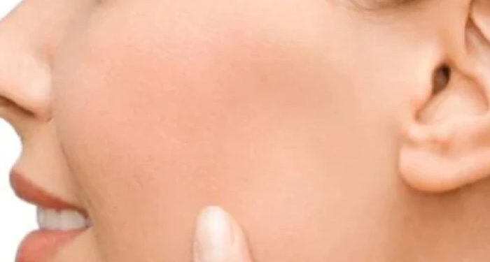 6 Outrageously Effective And Super-Easy Tips To Get Rid Of Facial Fat Quickly