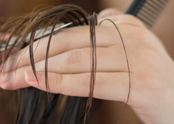6 Ways To Prevent Hair Loss While Losing Weight