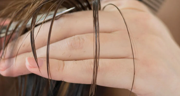 6 Ways To Prevent Hair Loss While Losing Weight