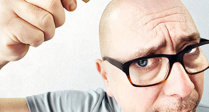 MicroRNA will regrow 90% of lost hair: study