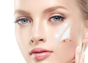 Why You Should Think Twice Before Removing a Skin Tag At Home