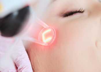 5 Reasons Why You Should Opt For Laser Skin Rejuvenation
