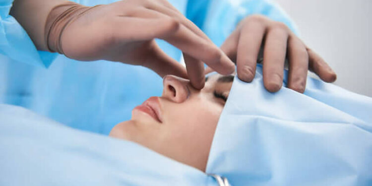 Rhinoplasty